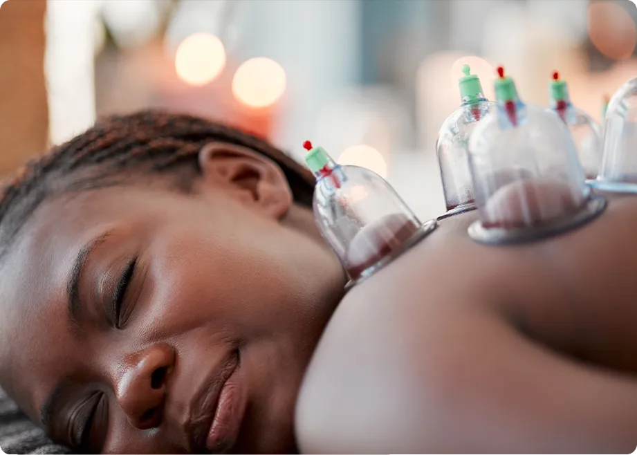 Person receiving a cupping massage treatment